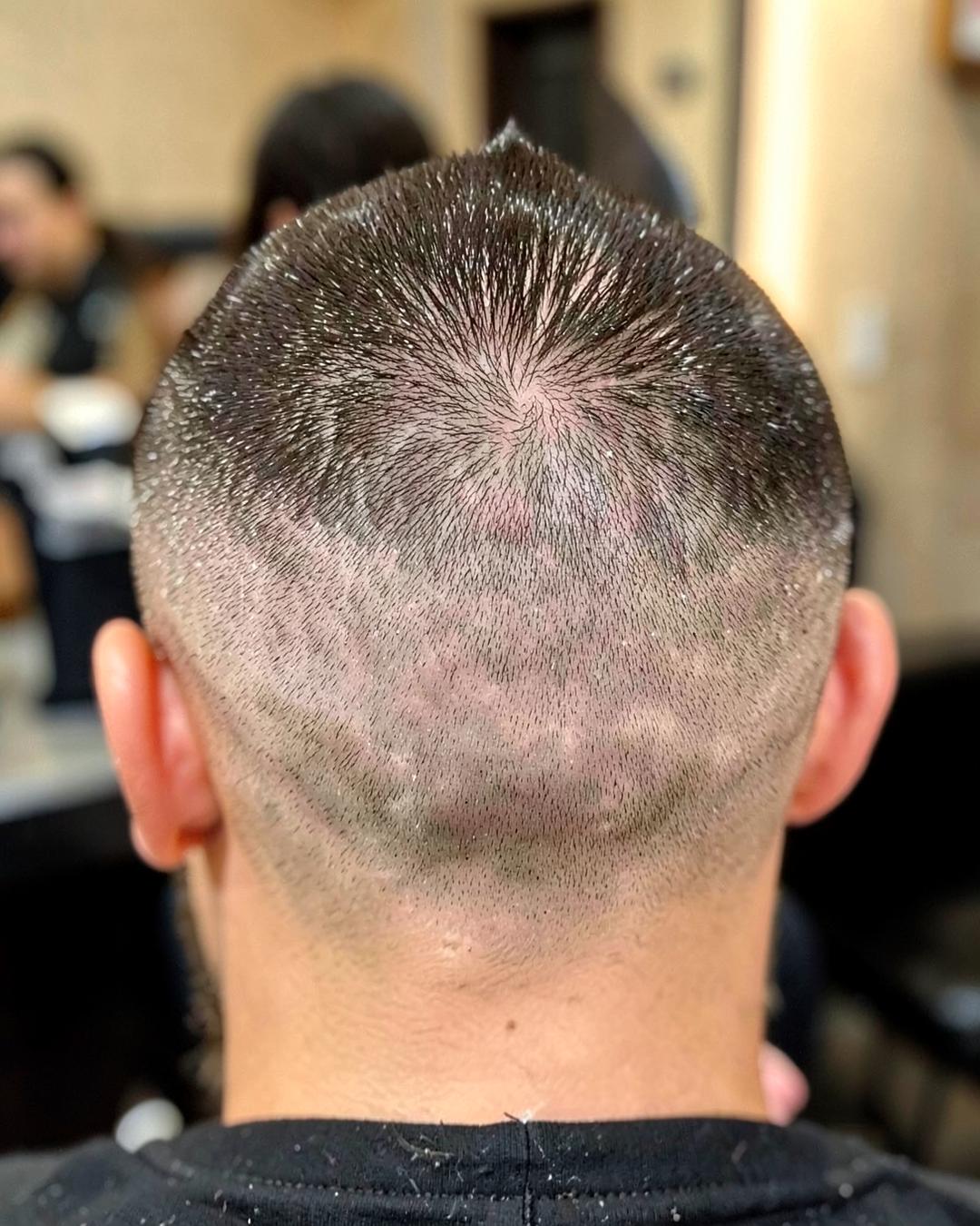 Fresh skin fade, taper detail at the back